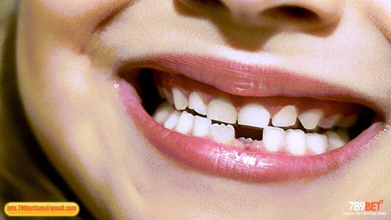 Bí Ẩn Giấc Mơ Rụng Răng: Lời Gợi Mở Cho Ván Lô Trúng Đậm? 3 Mộng thấy rụng răng hàm dưới